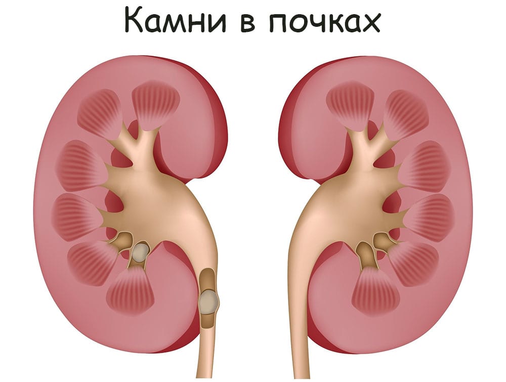 Kraken darknet ссылка тор